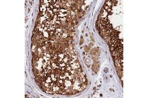 Immunohistochemical staining of human testis with CABP5 polyclonal antibody  shows strong cytoplasmic positivity in cells in seminiferus ducts. (CABP5 anticorps)