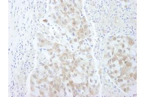 Immunohistochemistry (IHC) image for anti-Eukaryotic Translation Initiation Factor 4E Binding Protein 1 (EIF4EBP1) (C-Term) antibody (ABIN7448395) (eIF4EBP1 anticorps  (C-Term))