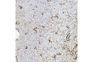Immunohistochemistry of paraffin-embedded rat brain using CHAT Rabbit pAb (ABIN3016134, ABIN3016135, ABIN3016136 and ABIN6219569) at dilution of 1:50 (40x lens). (Choline Acetyltransferase anticorps  (AA 331-630))