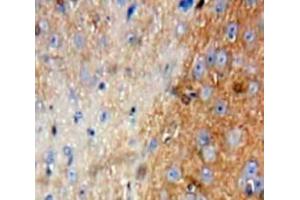 IHC-P analysis of Brain tissue, with DAB staining. (FIL1d anticorps  (AA 12-151))