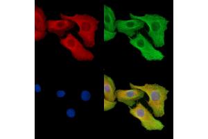 ABIN7095361 and ABIN7099418 staining Hela cells by IF/ICC.