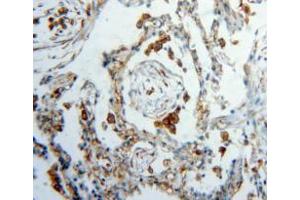 Used in DAB staining on fromalin fixed paraffin-embedded lung tissue (Vimentin anticorps  (AA 2-466))