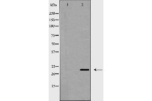 Western blot analysis of CD83 expression in HeLa cells,The lane on the left is treated with the antigen-specific peptide. (CD83 anticorps  (Internal Region))