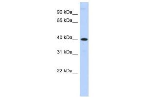 MPPE1 antibody used at 1 ug/ml to detect target protein.