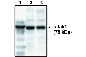 Western blot analysis using c-tak1 antibody . (TR4 anticorps)
