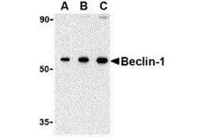 Western Blotting (WB) image for anti-Beclin 1, Autophagy Related (BECN1) (N-Term) antibody (ABIN2477609) (Beclin 1 anticorps  (N-Term))
