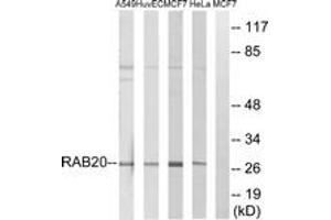 Western blot analysis of extracts from HeLa/MCF-7/HuvEc/A549 cells, using RAB20 Antibody.
