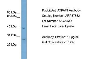 WB Suggested Anti-ATPAF1  Antibody Titration: 0.