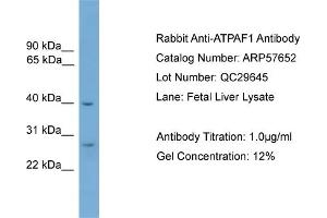 WB Suggested Anti-ATPAF1  Antibody Titration: 0. (ATPAF1 anticorps  (Middle Region))