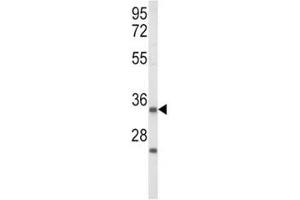 Western blot analysis of IGFBP2 antibody and Jurkat lysate (IGFBP2 anticorps  (AA 277-305))