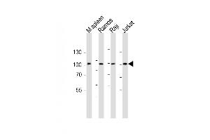 All lanes : Anti-BCL6 Antibody (Center) at 1:1000 dilution Lane 1: mouse spleen lysate Lane 2: Ramos whole cell lysate Lane 3: Raji whole cell lysate Lane 4: Jurkat whole cell lysate Lysates/proteins at 20 μg per lane. (BCL6 anticorps  (AA 364-395))