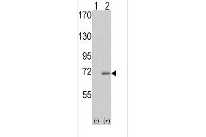 Western blot analysis of IRAK1 (arrow) using rabbit polyclonal IRAK Antibody (C-term) . (IRAK1 anticorps  (C-Term))
