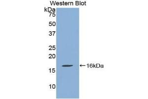 Detection of Recombinant QSOX1, Human using Polyclonal Antibody to Quiescin Q6 Sulfhydryl Oxidase 1 (QSOX1) (QSOX1 anticorps  (AA 394-519))