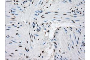 Image no. 10 for anti-Protein Phosphatase 5, Catalytic Subunit (PPP5C) antibody (ABIN1500389)