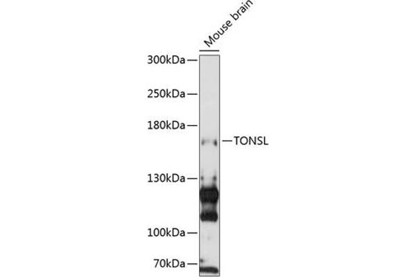 NFKBIL2 anticorps  (AA 160-390)