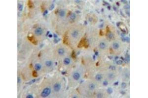 Used in DAB staining on fromalin fixed paraffin-embedded Liver tissue (LILRB3 anticorps  (AA 410-631))