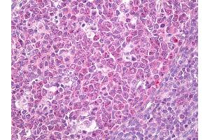 Anti-ADRM1 antibody IHC of human tonsil, germinal center. (ADRM1 anticorps)