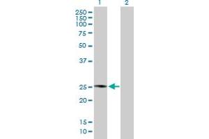 Western Blot analysis of PLA2G4D expression in transfected 293T cell line by PLA2G4D MaxPab polyclonal antibody. (PLA2G4D anticorps  (AA 1-216))