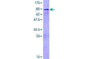 Image no. 1 for F-Box and Leucine-Rich Repeat Protein 3 (FBXL3) (AA 1-428) protein (GST tag) (ABIN1353747)