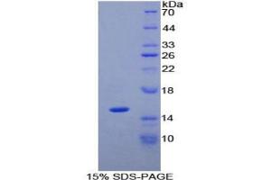 SDS-PAGE analysis of Human PLAA Protein.
