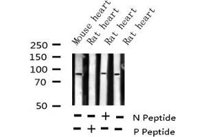 Western blot analysis of Phospho-ATRIP (Ser68) expression in various lysates (ATRIP anticorps  (pSer68))
