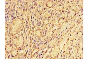 Immunohistochemistry of paraffin-embedded human gastric tissue using ABIN7176604 at dilution of 1:100 (SLUG anticorps  (AA 12-124))