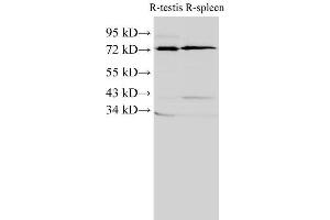 Western Blot analysis of Rat testis and Rat spleen using ANXA6 Polyclonal Antibody at dilution of 1:2000 (ANXA6 anticorps)