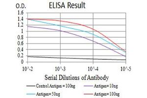 Black line: Control Antigen (100 ng),Purple line: Antigen (10 ng), Blue line: Antigen (50 ng), Red line:Antigen (100 ng)