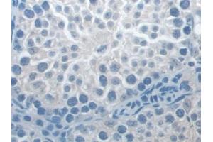 Detection of NLRP3 in Mouse Testis Tissue using Polyclonal Antibody to NLR Family, Pyrin Domain Containing Protein 3 (NLRP3)