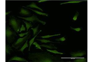 Immunofluorescence of monoclonal antibody to CSNK2A2 on HeLa cell.
