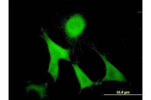 Immunofluorescence of monoclonal antibody to GAS2 on NIH/3T3 cell.