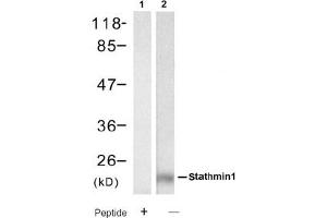 Image no. 2 for anti-Stathmin 1 (STMN1) (Ser62) antibody (ABIN319391) (Stathmin 1 anticorps  (Ser62))