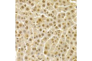 Immunohistochemistry of paraffin-embedded human liver injury using CDK4 Antibody.