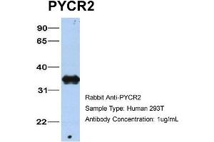 Host: Rabbit Target Name: PYCR2 Sample Type: 293T Antibody Dilution: 1. (PYCR2 anticorps  (C-Term))