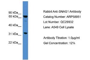 WB Suggested Anti-SNAG1  Antibody Titration: 0. (SNX18 anticorps  (Middle Region))