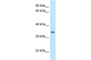 WB Suggested Anti-Hoxc11 Antibody Titration: 1.