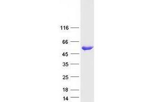 Validation with Western Blot