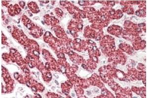 AP21283PU-N ETFB antibody staining paraffin embedded Human Liver at 3. (ETFB anticorps  (Internal Region))