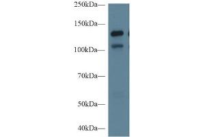 Rabbit Capture antibody from the kit in WB with Positive Control: Sample Human Hela cell lysate;. (MGEA5 Kit ELISA)