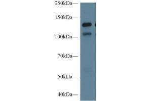 Rabbit Capture antibody from the kit in WB with Positive Control: Sample Human Hela cell lysate;. (MGEA5 Kit ELISA)