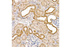 Immunohistochemistry of paraffin-embedded rat ovary using  Rabbit pAb (ABIN3021090, ABIN3021091, ABIN3021092 and ABIN6213948) at dilution of 1:50 (40x lens).