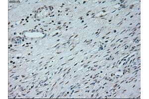 Immunohistochemical staining of paraffin-embedded Kidney tissue using anti-NEUROG1mouse monoclonal antibody. (Neurogenin 1 anticorps)