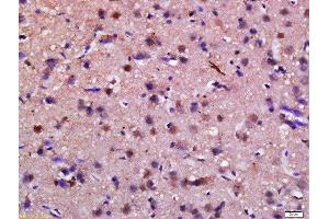 Formalin-fixed and paraffin embedded rat brain labeled with Anti-Syndetin Polyclonal Antibody, Unconjugated  at 1:200 followed by conjugation to the secondary antibody and DAB staining. (Syndetin (VPS50) (AA 3-100) anticorps)