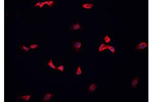 ABIN6266582 staining HeLa cells by IF/ICC.
