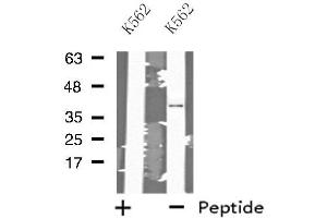 Western blot analysis of extracts from K562 cells, using MRPL3 antibody. (MRPL3 anticorps  (N-Term))