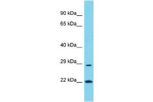 Host: Rabbit Target Name: POLR3G Sample Type: COLO205 Whole Cell lysates Antibody Dilution: 1. (POLR3G anticorps  (Middle Region))