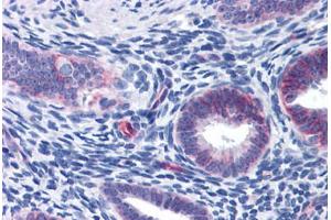 Human Uterus: Formalin-Fixed, Paraffin-Embedded (FFPE) (WDHD1 anticorps  (AA 611-660))