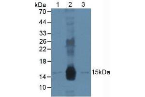 Figure. (DDB2 anticorps  (AA 166-383))