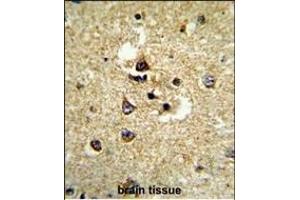 Formalin-fixed and paraffin-embedded human brain tissue reacted with CYP7B1 Antibody (Center), which was peroxidase-conjugated to the secondary antibody, followed by DAB staining.
