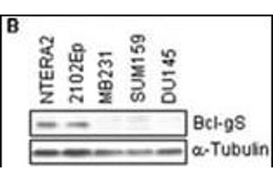 Cell lysates were subjected to Western blotting to determine the expression of Bcl-gS protein.